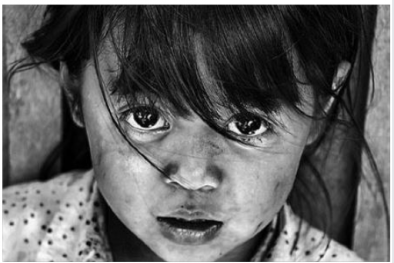 Lòng tốt của cộng đồng và thái độ vô cảm của Bộ y tế